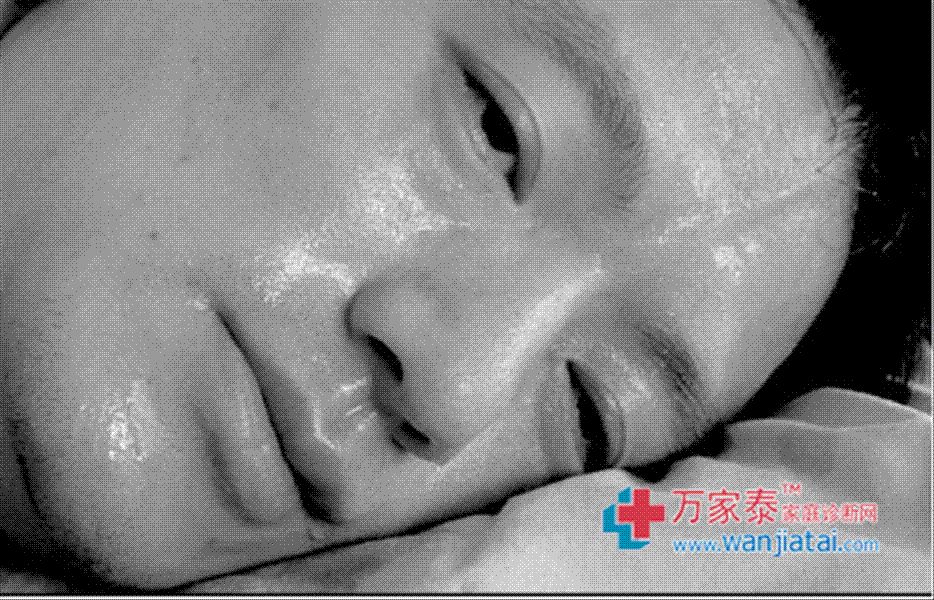 盜汗 盜汗
