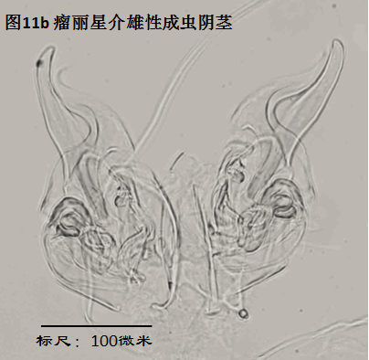 圖11b 圖11b